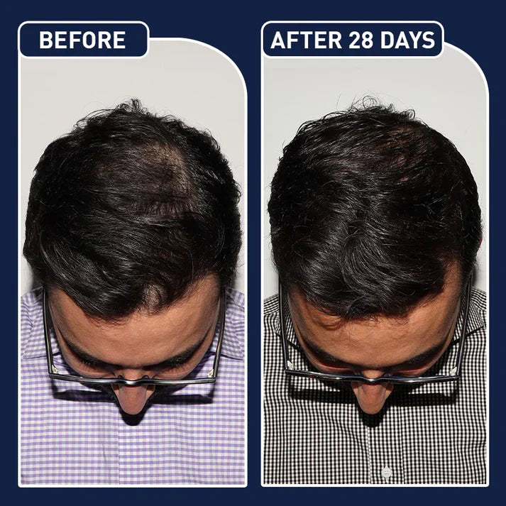 FEG Hair Growth Spray – Natural Hair Thickening & Scalp Repair | Souqazam UAE