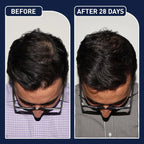 FEG Hair Growth Spray – Natural Hair Thickening & Scalp Repair | Souqazam UAE