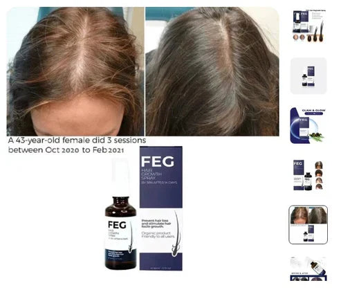 FEG Hair Growth Spray – Natural Hair Thickening & Scalp Repair | Souqazam UAE