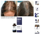 FEG Hair Growth Spray – Natural Hair Thickening & Scalp Repair | Souqazam UAE