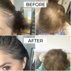FEG Hair Growth Spray – Natural Hair Thickening & Scalp Repair | Souqazam UAE