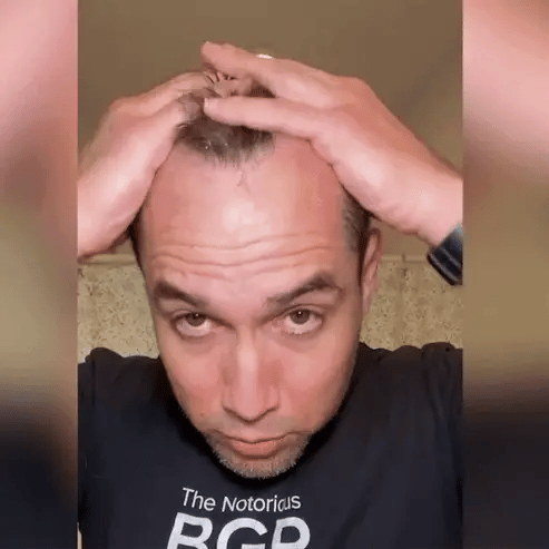 FEG Hair Growth Spray – Natural Hair Thickening & Scalp Repair | Souqazam UAE